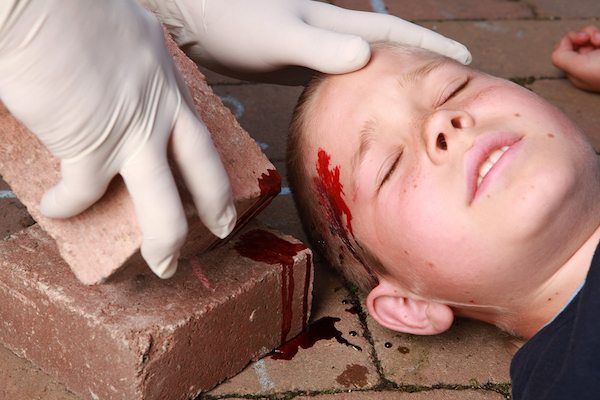 Boy With Head Injury Boy With Head Injury